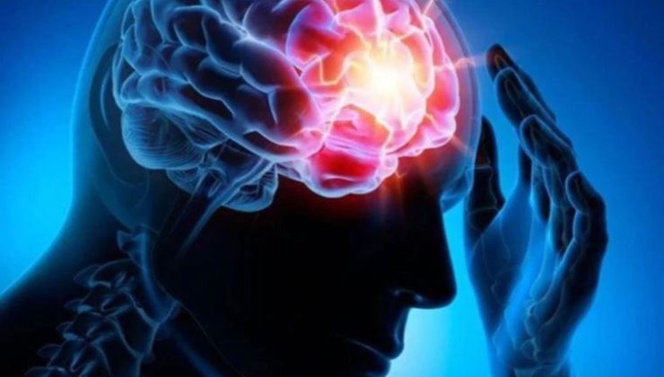 Epilepsi: Nedenleri, Belirtileri ve Tedavi Yöntemleri