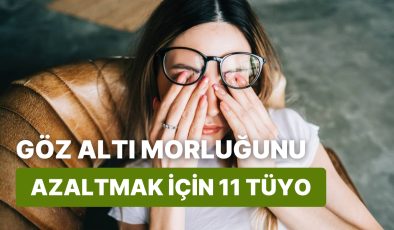 Göz Altı Morluklarıyla Savaşmak İçin 11 Etkili Yöntem