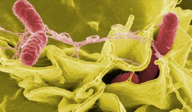 Salmonella Nedir? Bulaşma Yolları ve Belirtileri