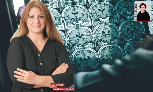 Türk bilim insanının çalışmaları Alzheimer için ilaç umudu oldu